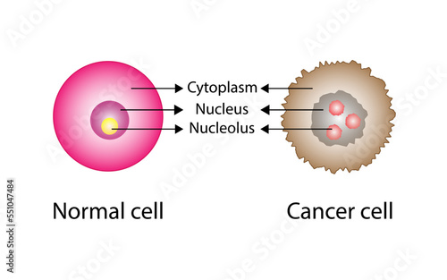 Normal cell and cancer cell. Difference between normal and tumor cell. Scientific design. Vector Illustration.