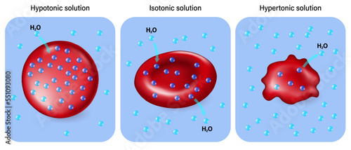 Hypotonic, Isotonic and  Hypertonic solutions vector. Tonicity and osmosis.