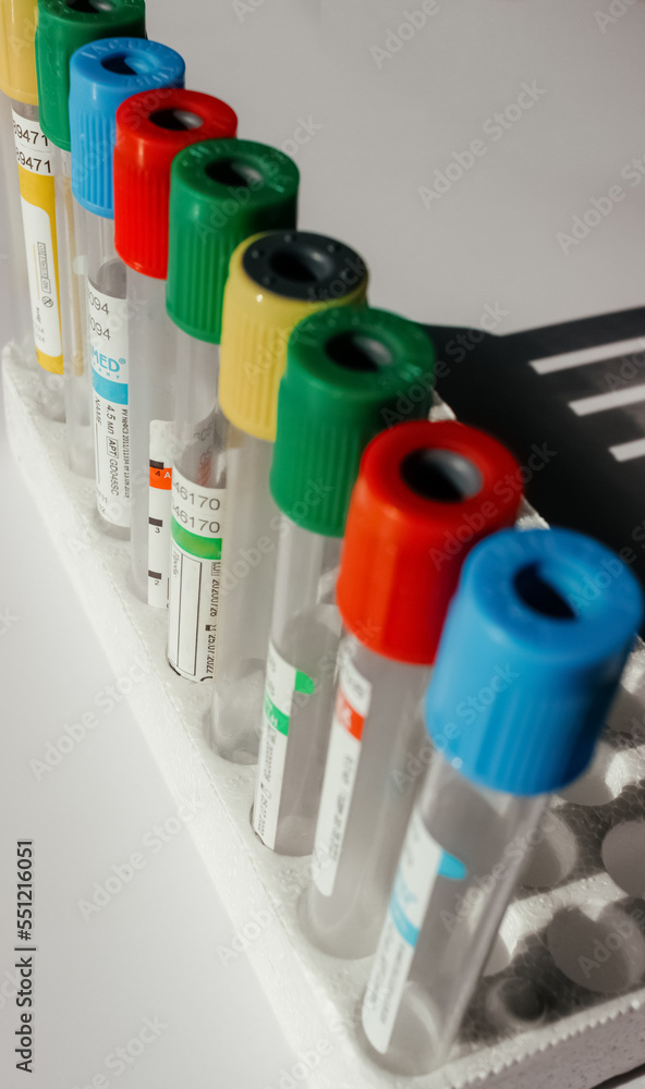 Blood Drawing equipment in laboratory for analysis Blood Drawing equipment in laboratory for analysis