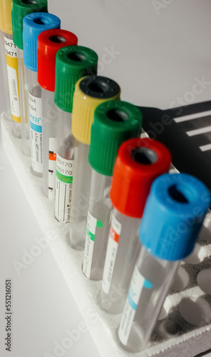 Blood Drawing equipment in laboratory for analysis