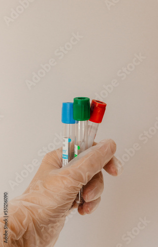Glass test tube in the hands of a scientist. A scientistin rubber disposable gloves holds a laboratory flask and for analysis.