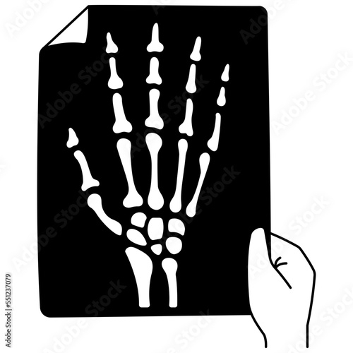 Hand bone x-ray