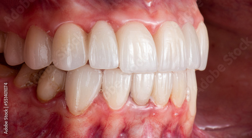 dental photography picture of dental treatment case