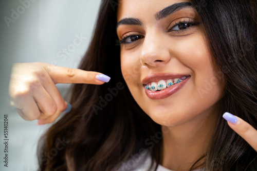 Cute young woman with dental braces smiling and pointing to them