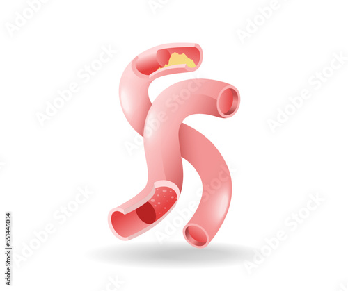 Isometric flat 3d illustration of blood vessel duct anatomy concept