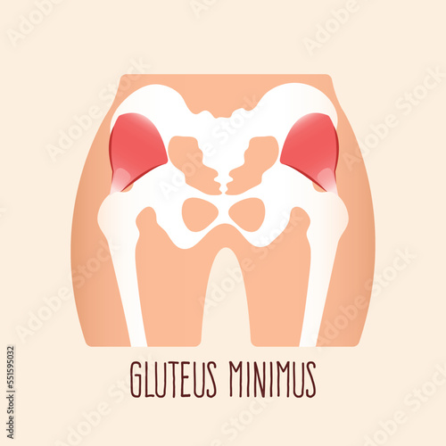 Vector illustration of gluteus minimus muscle.