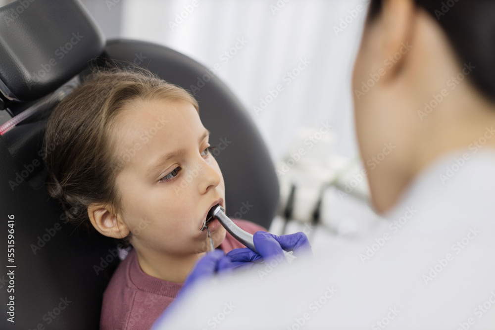Top angle view of cute little girl lying on dentist chair with open mouth while young female doctor curing her teeth, using dental drill. Caries prevention and treatment. Child at dental clinic. Top angle view of cute little girl lying on dentist chair with open mouth while young female doctor curing her teeth, using dental drill. Caries prevention and treatment. Child at dental clinic.