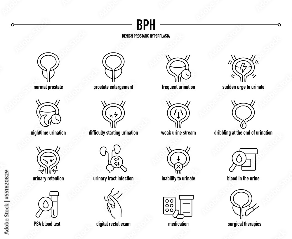BPH, Benign Prostatic Hyperplasia symptoms, diagnostic and treatment ...