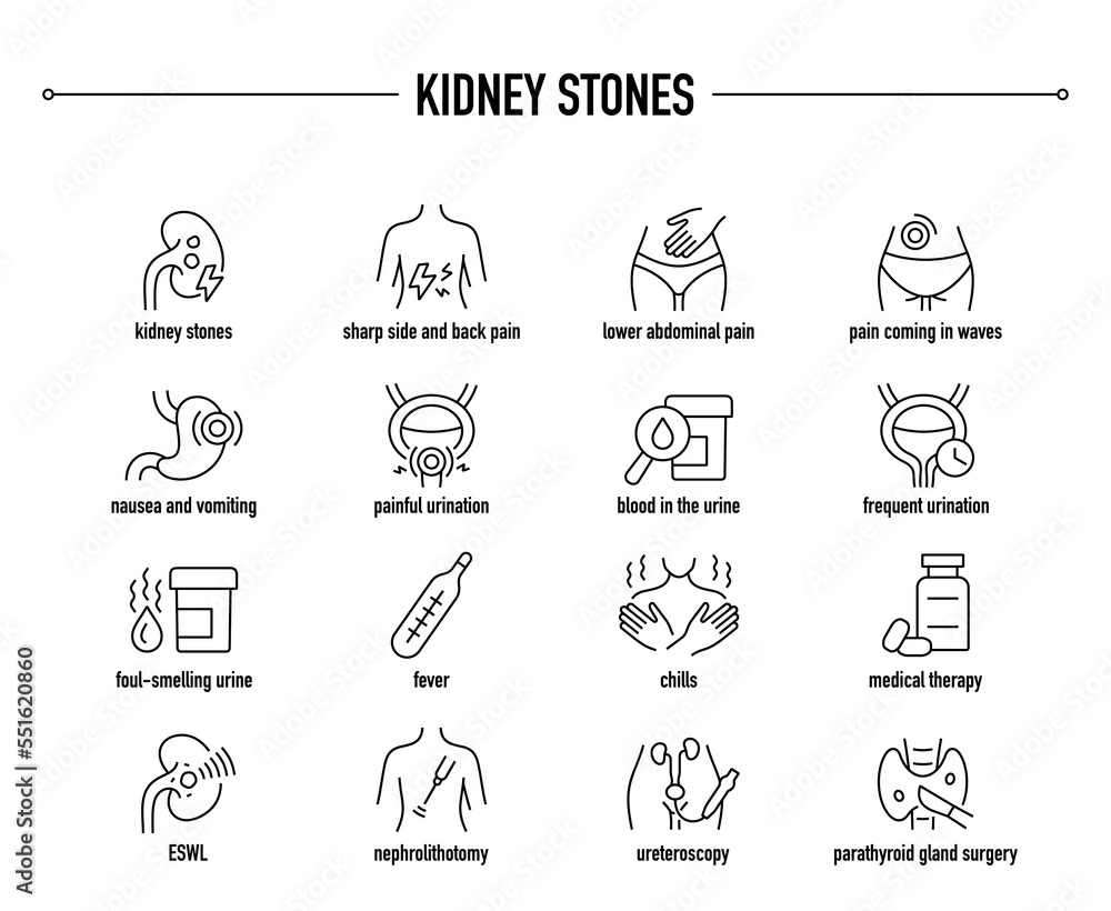 Kidney Stones symptoms, diagnostic and treatment vector icon set. Line editable medical icons.