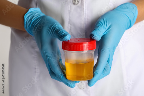 Nurse holding container with urine sample for analysis on white background, closeup © New Africa
