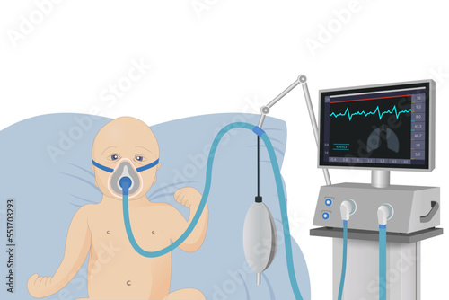 A small child lies in a hospital bed with an oxygen mask on a ventilator in critical condition. Emergency medical care. Resuscitation of patients.