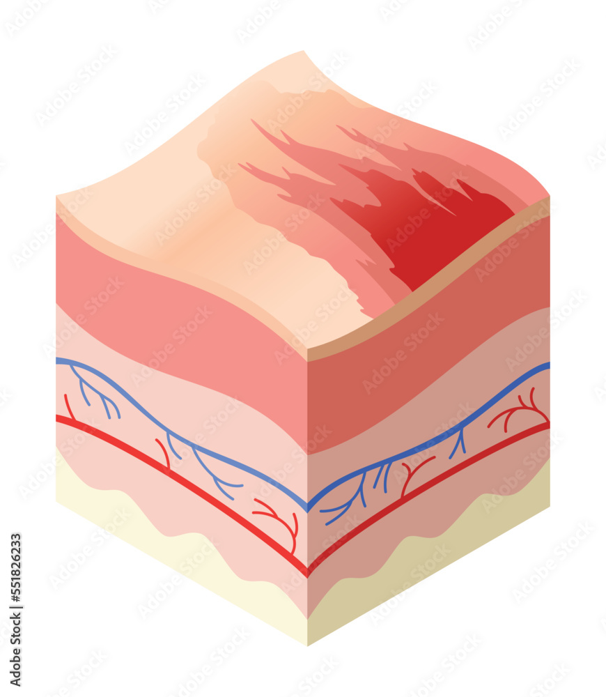 Vetor de Skincare medical concept. Problems in crosssection of human