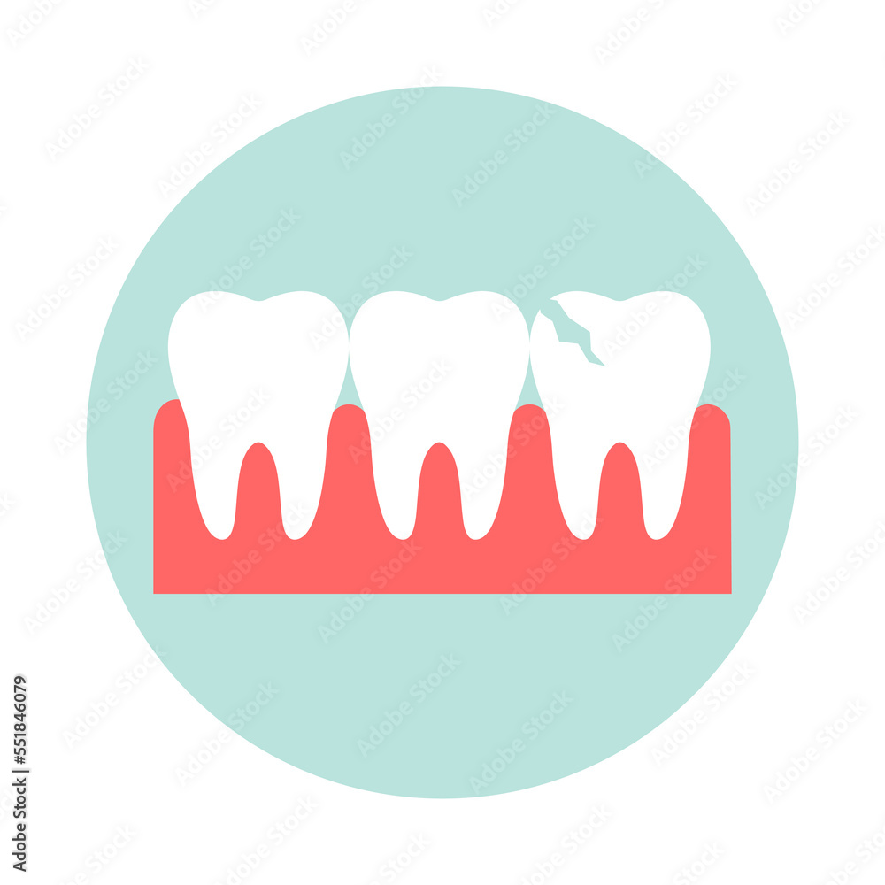 Row of healthy teeth and a cracked tooth. Flat vector illustration. Row of healthy teeth and a cracked tooth. Flat vector illustration.