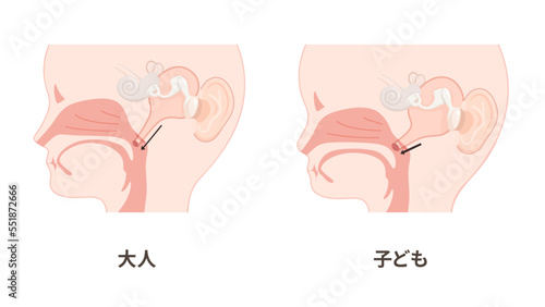 大人と子どもの耳管のイラスト_矢状断