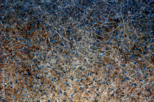 Rhizopus stolonifer or white bread mold, It is found on all types of mouldy materials. Can cause the disease Zygomycosis