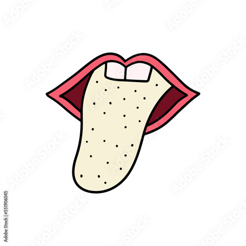 Rash on tongue. Symptom of candidiasis, scarlet fever. .Infection in the oral cavity, health care. Vector illustration in flat style
