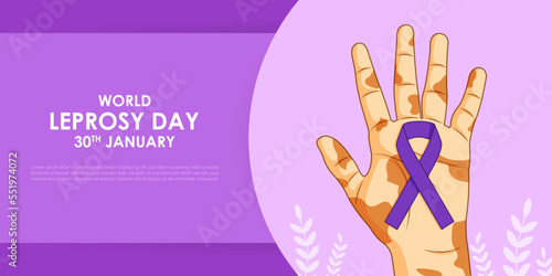 Fotografia, Obraz Vector illustration of World Leprosy Day 30 January