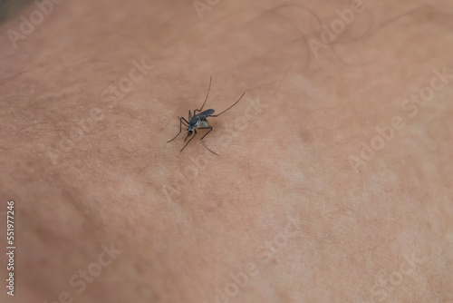 The Aedes albopictus mosquito perches on human skin. Human blood-sucking mosquito © kanurism