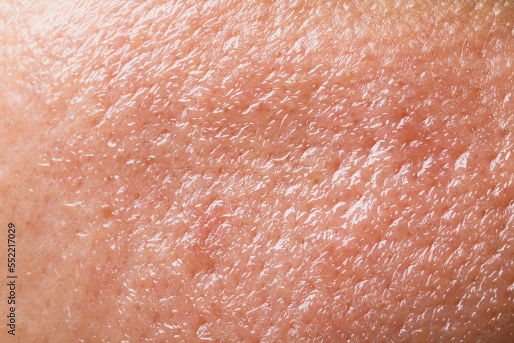 Fototapeta premium Closeup view of human oily skin as background