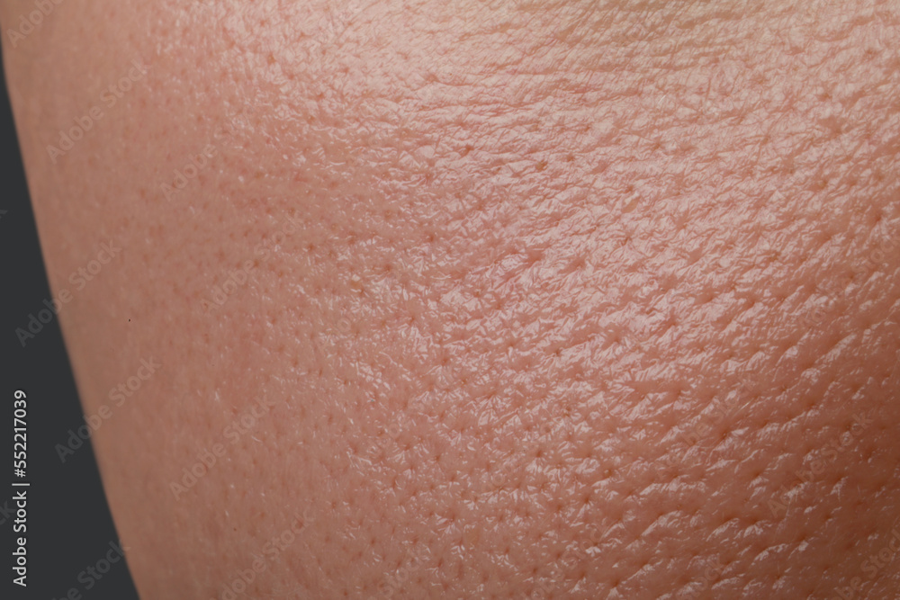 Fototapeta premium Closeup view of human oily skin as background