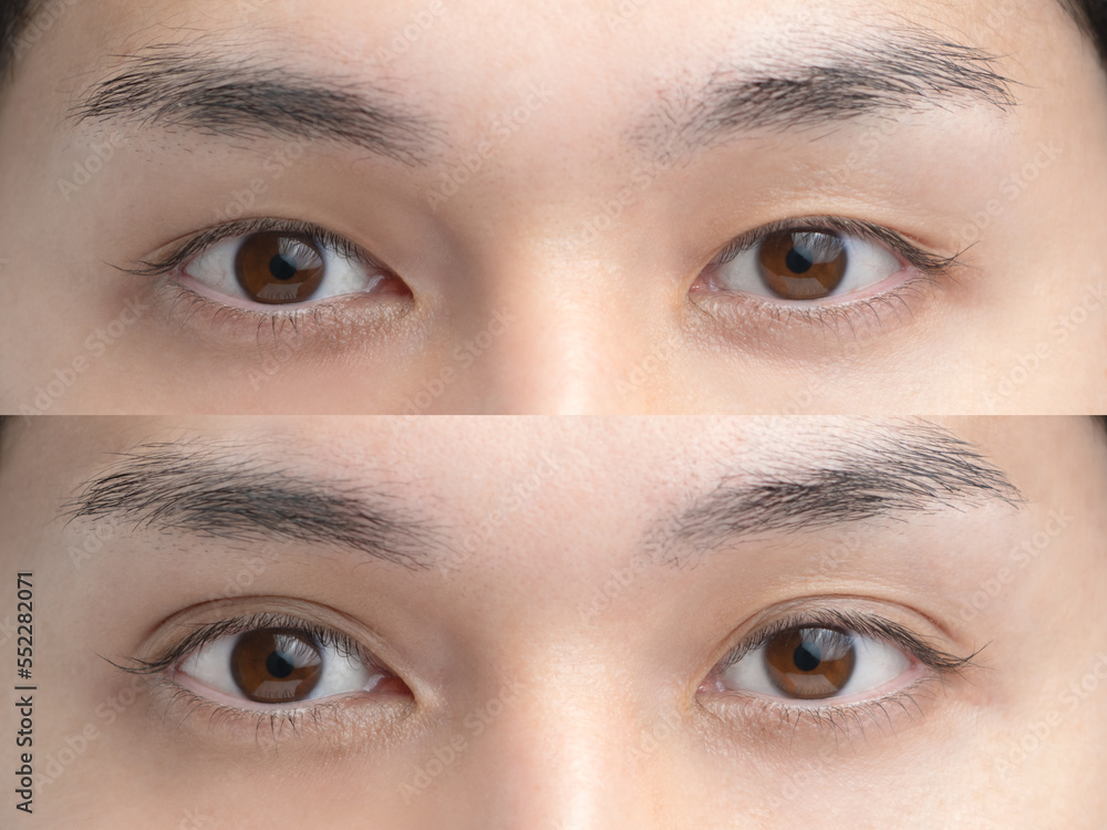 Fototapeta premium 美容整形 イメージ