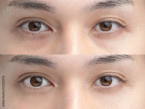 美容整形　イメージ