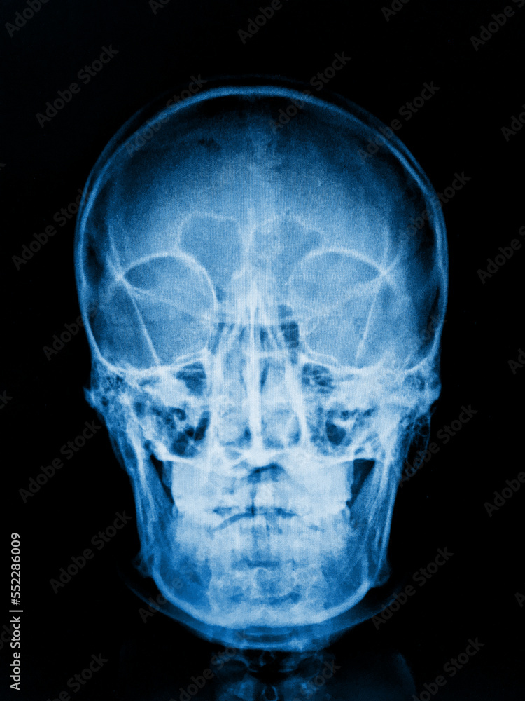 human skull ray human skull ray