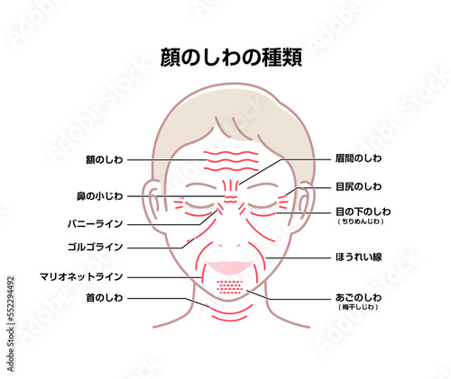 女性の顔のしわ ( 発生場所と名称 ) ベクターイラスト
