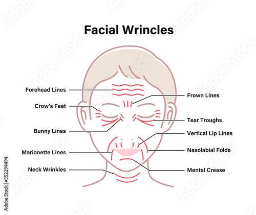 Facial wrinkles ( female face ) vector illustration