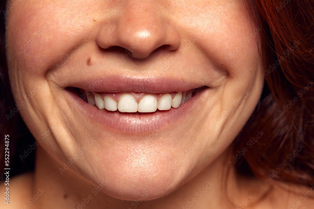 Close-up view of female perfect shape mouth with nude colored lipstick. Smiling. Cosmetological and dental care Close-up view of female perfect shape mouth with nude colored lipstick. Smiling. Cosmetological and dental care