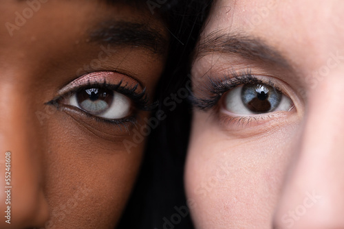 Fototapeta Heterochromia in light eye and dark eye