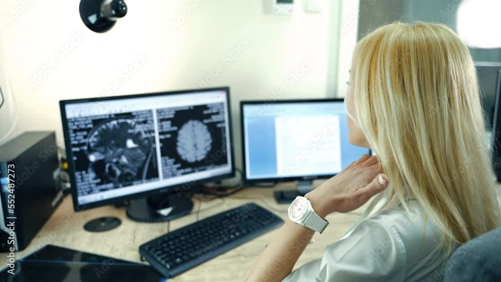 Professional neurologist looking at MRI image of patient’s head. Doctor analyzing CT scan to establish diagnosis. Professional neurologist looking at MRI image of patient’s head. Doctor analyzing CT scan to establish diagnosis.