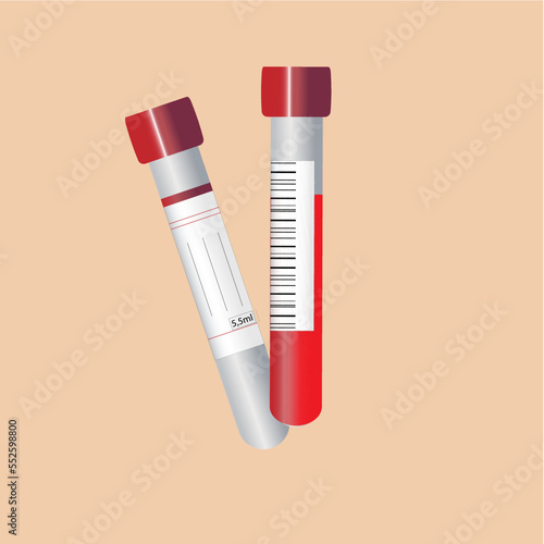 test tube