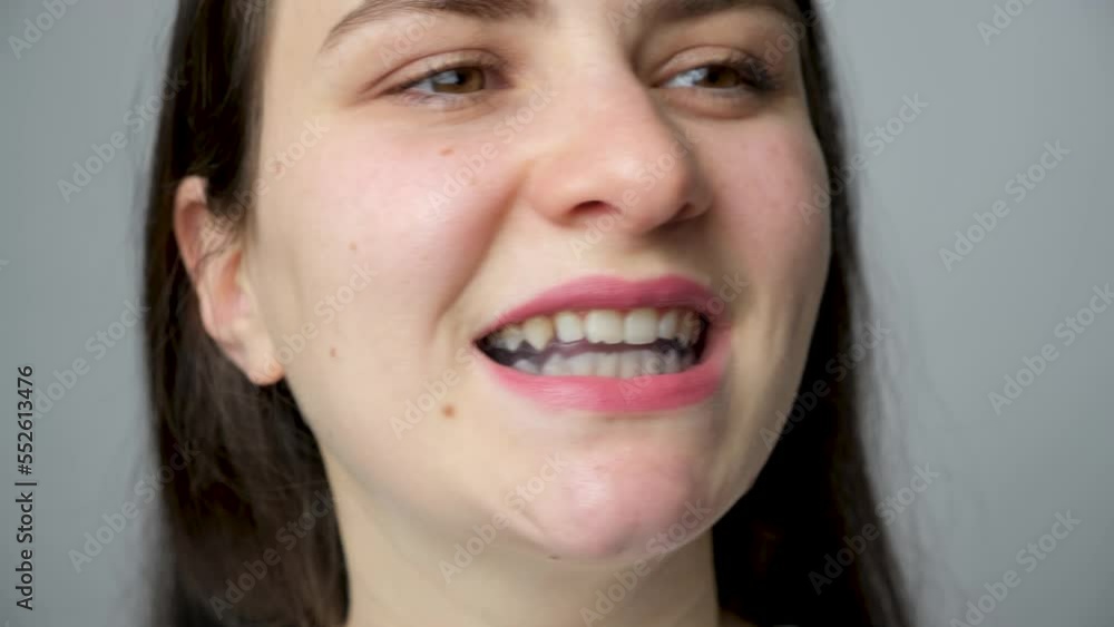 Dental mouthguard, splint in the mouth for the treatment of dysfunction of the temporomandibular joints, bruxism, malocclusion, to relax the muscles of the jaw. Dental mouthguard, splint in the mouth for the treatment of dysfunction of the temporomandibular joints, bruxism, malocclusion, to relax the muscles of the jaw.