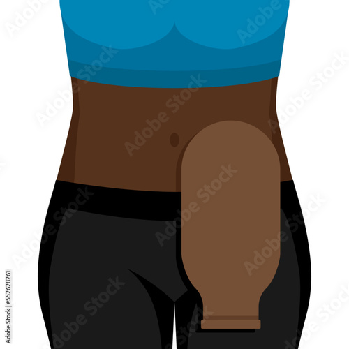 Young black woman with colostomy bag photo
