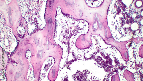 Human red bone marrow, hematopoietic tissue. Hematoxylin and eosin stain. 