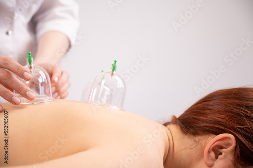 Female massage therapist uses vacuum cans on the patient's back. 