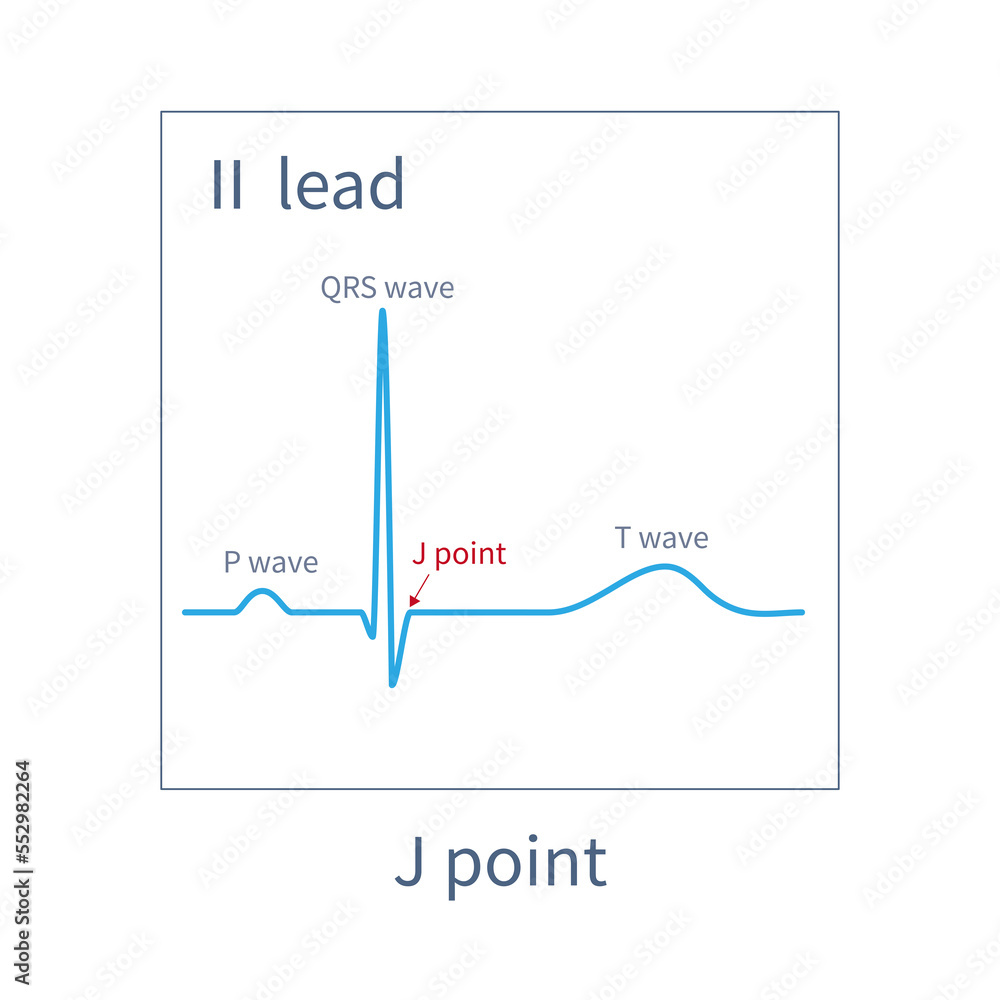On the ECG, J point is the junction point between the end point of the