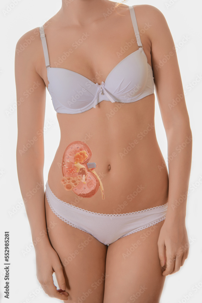 beautiful young woman body with kidney hologram. Kidney disease, stones beautiful young woman body with kidney hologram. Kidney disease, stones