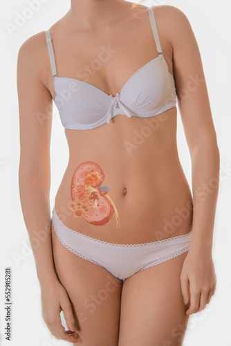 beautiful young woman body with kidney hologram. Kidney disease, stones