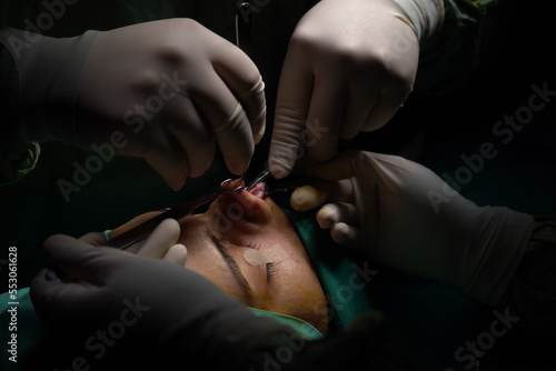Doctor performing nose surgery in the operating room.  green dresses and black room in the operating room 