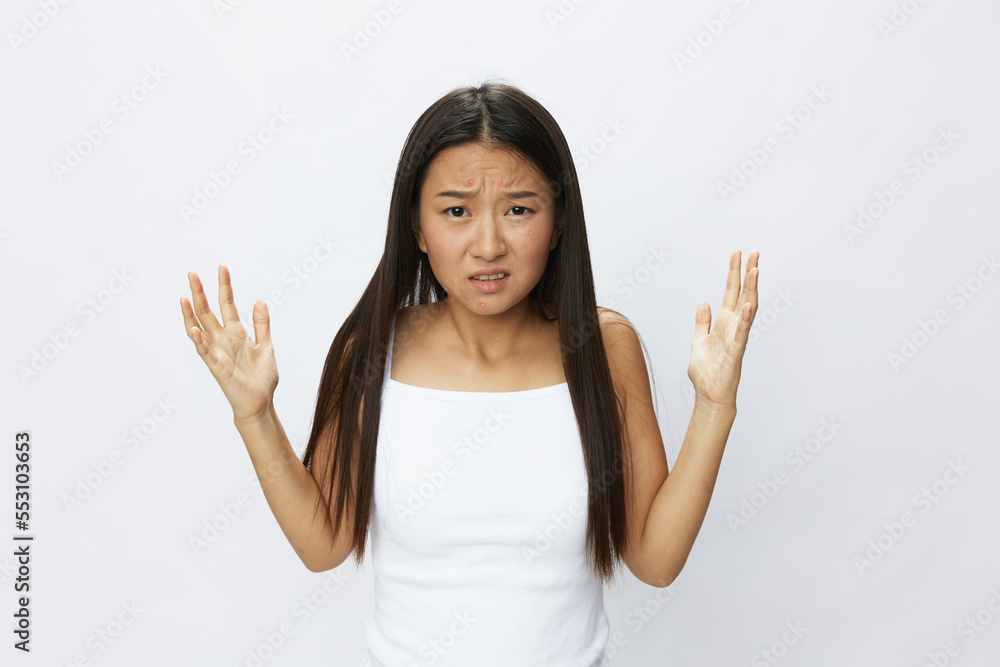 Asian woman facial skin problems, acne and inflammation, red rashes and allergies, chicken pox, sadness from rashes. Facial skin care concept for diseases and nerves Asian woman facial skin problems, acne and inflammation, red rashes and allergies, chicken pox, sadness from rashes. Facial skin care concept for diseases and nerves