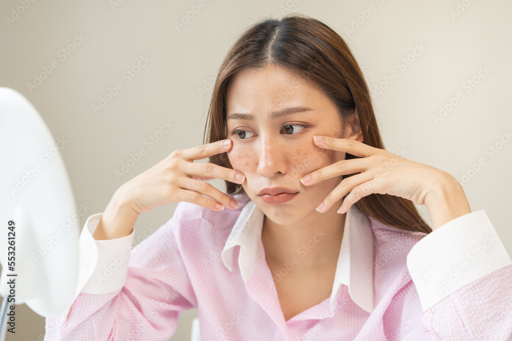 Dermatology, expression face worry asian young woman looking mirror hand touch facial at dark spot of melasma, freckles from pigment melanin, allergy sun. Beauty care, skin problem treatment, skincare Dermatology, expression face worry asian young woman looking mirror hand touch facial at dark spot of melasma, freckles from pigment melanin, allergy sun. Beauty care, skin problem treatment, skincare