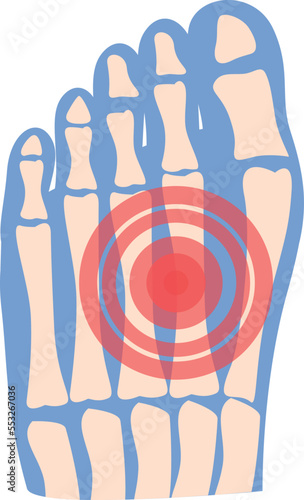 Foot arthritis icon cartoon vector. Joint pain. Medical articulation