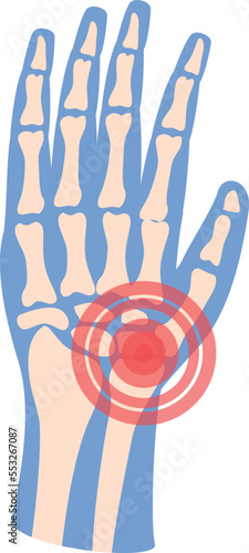 Hand arthritis icon cartoon vector. Joint pain. Medical patient