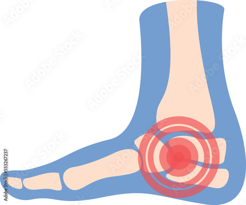 Heel pain icon cartoon vector. Arthritis joint. Medical treatment