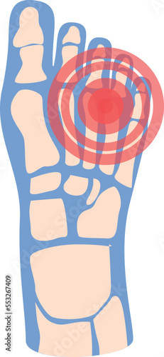 Food pain icon cartoon vector. Medical patient. Treatment articulation