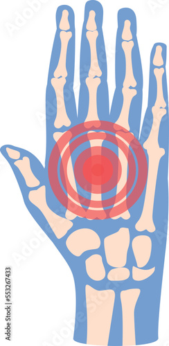 Hand pain icon cartoon vector. Arthritis joint. Medical patient