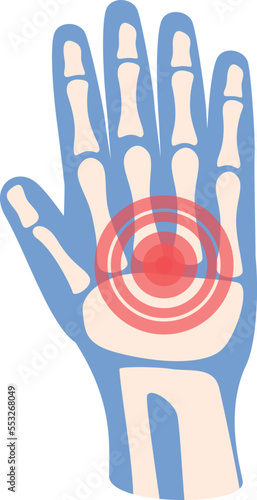 Hand pain icon cartoon vector. Medical treatment. Arthritis joint