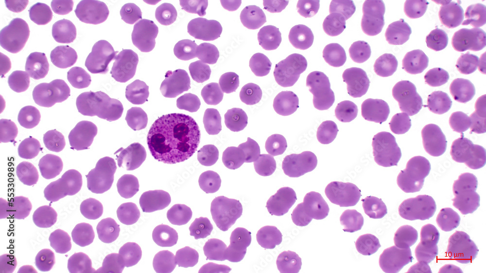 Light micrograph showing human blood cells. Erythrocytes are pink. They make up the majority of blood cells. Also in the center you can see a large cell with a nucleus (neutrophil).	